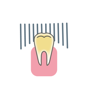 歯が黄色い？！〜原因・対処法・取り方〜