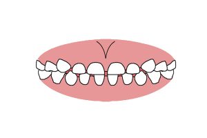 お子様の歯並びをチェックしてみましょう