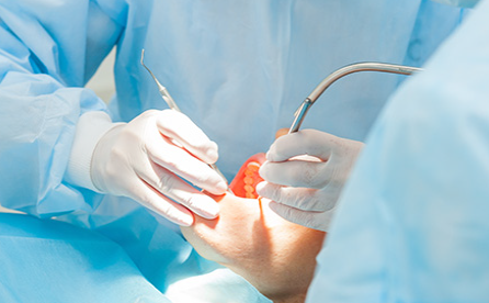 歯を失う最大の原因である疾患歯周病治療